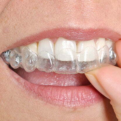 Teen Invisalign Program