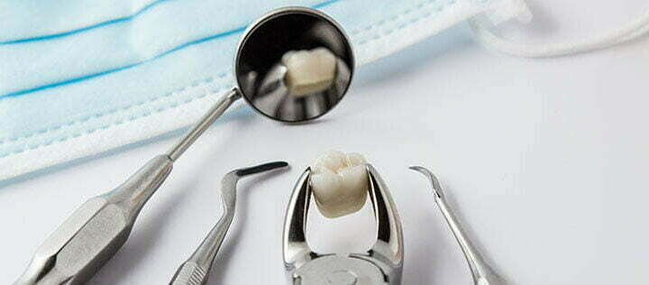 emergency tooth pulling